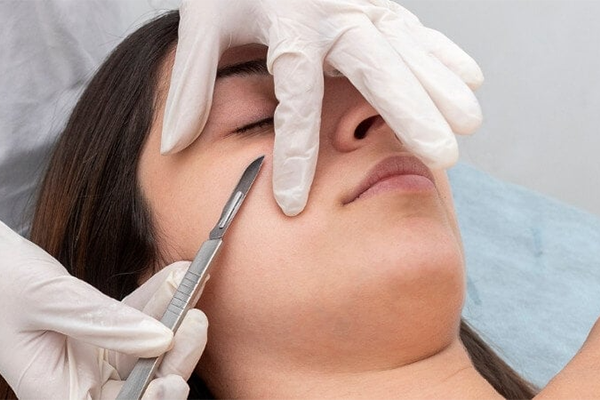 Dermaplaning at Summit Wellness & Spa in Anchorage, Alaska