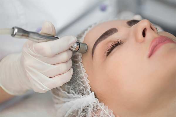 Microdermabrasion at Summit Wellness & Spa in Anchorage, Alaska