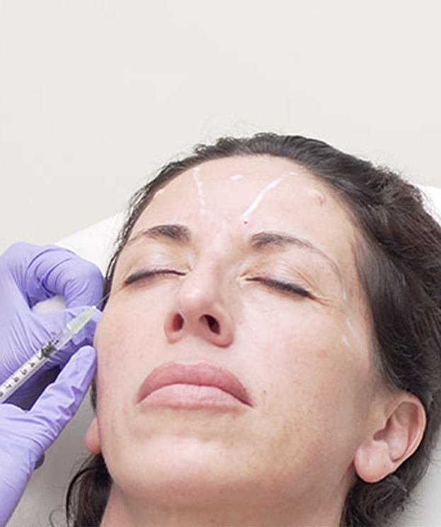 Botox treatment at Summit Wellness & Spa in Anchorage, Alaska