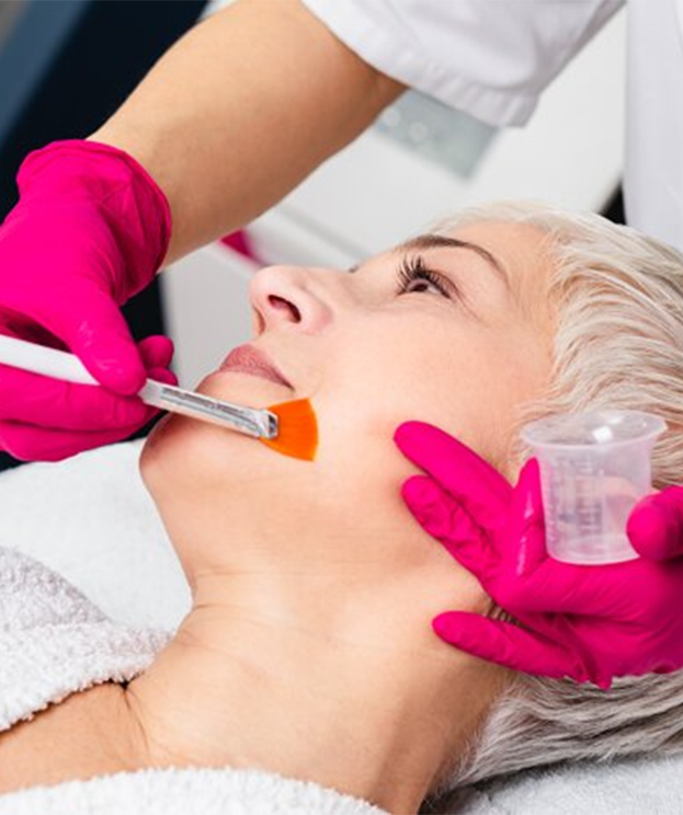 Chemical peel treatment at Summit Wellness & Spa in Anchorage, Alaska
