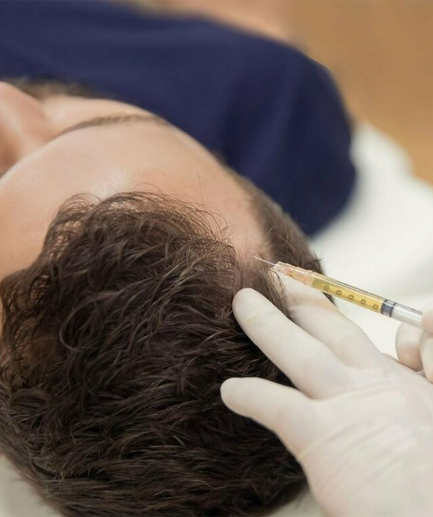 Platelet-rich plasma PRP therapy at Summit Wellness & Spa in Anchorage, Alaska